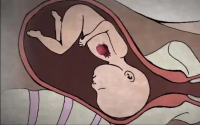 “This Changes My Whole View Of Abortions …”