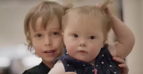 People With Down Syndrome Are Applying To Be On The Endangered List