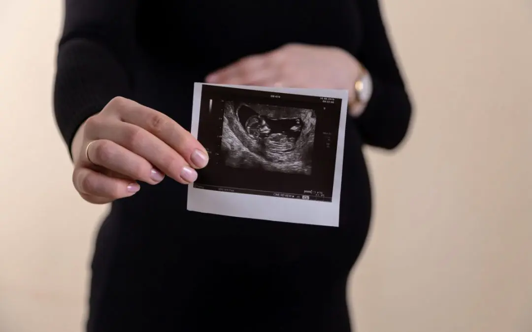 Roe v. Wade Overturned: Now The Hard Work Begins